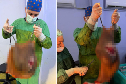 Aydın'da 67 yaşındaki karnından 40 kilogram kitle çıkarıldı