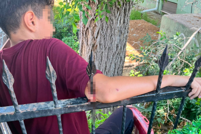 Adana'da demir korkuluk öğrencinin koluna saplandı, itfaiye kurtardı