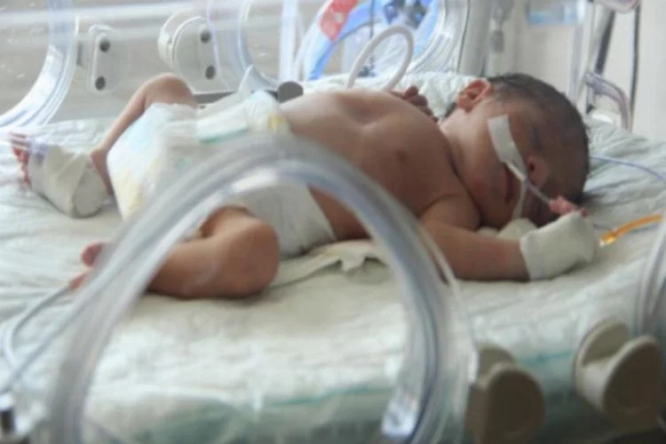 Babası annesini ona hamileyken katletti! Talihsiz bebeğin yaşam savaşı sürüyor