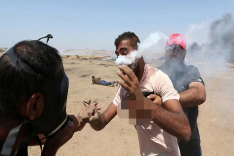Gaz bombası Filistinli göstericiyi ağzından yaraladı