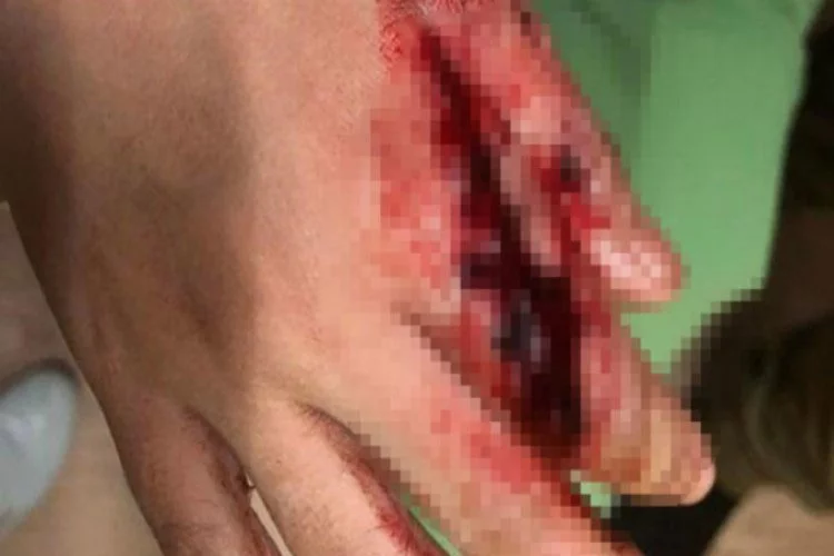 Korkunç olay! AVM'de köpek balığı saldırdı