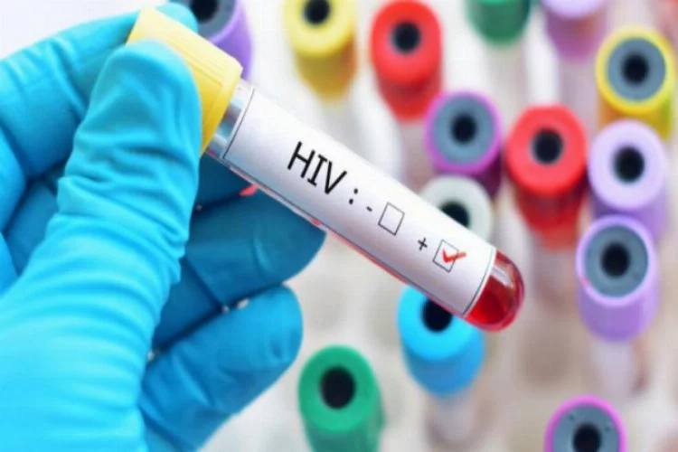 İl Sağlık Müdürü'nden HIV virüsü açıklaması