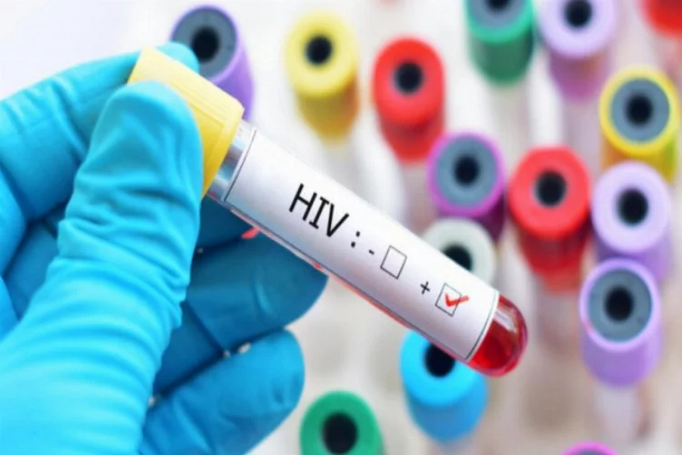 Türkiye'de HIV Pozitif sayısı arttı