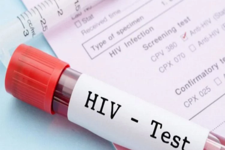 3 binden fazla hastaya HIV veya hepatit bulaşmış olabilir
