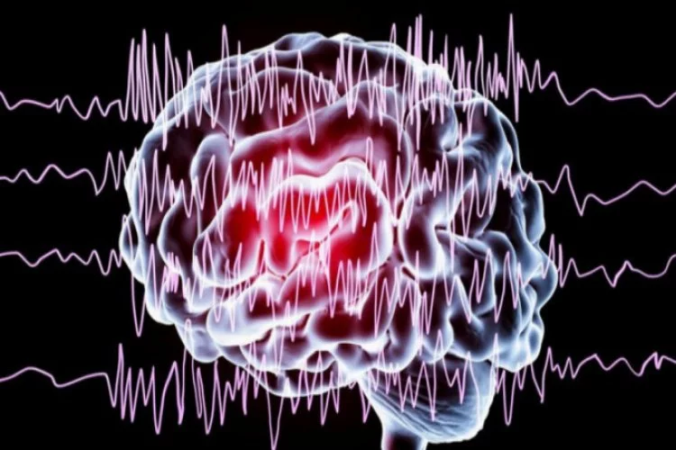 Epilepsiye "pilli" tedavi