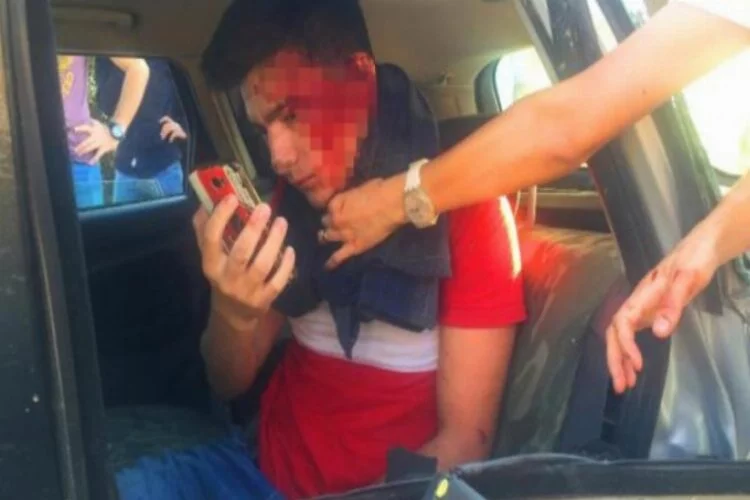 Kazada yaralandı, yüzünü kontrol etmek için selfie çekti