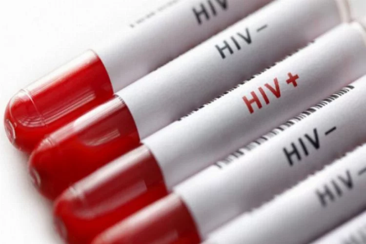 Türkiye'de korkutan artış! Yılda 3-4 bin kişiye HIV bulaşıyor