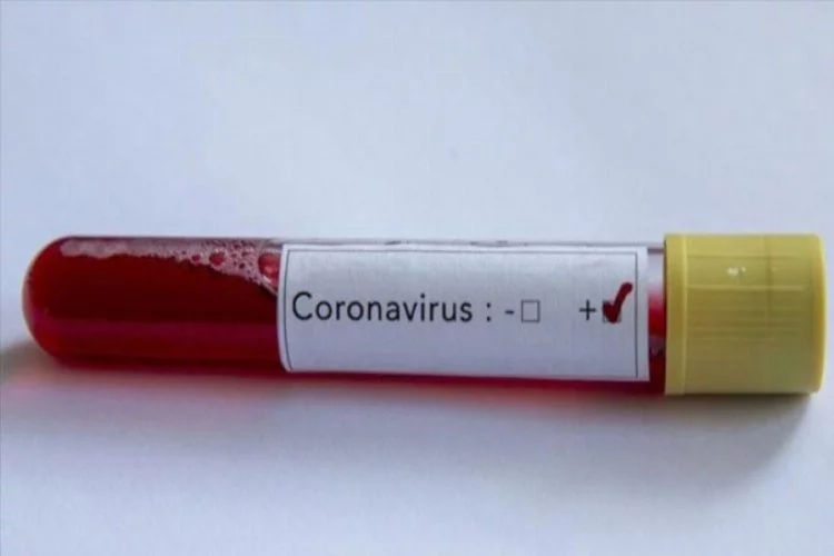 Eski Dışişleri Bakan Vekili koronavirüs nedeniyle hayatını kaybetti!