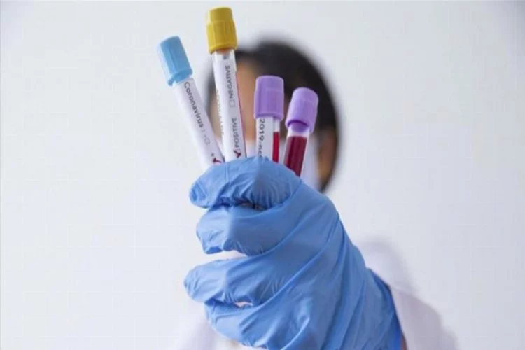 ABD'de yaşan Türk çift koronavirüs test kiti üretti