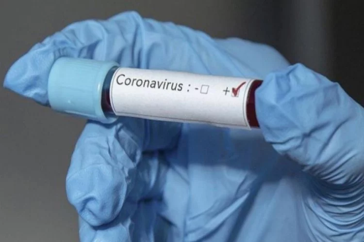 Zimbabve'de koronavirüsten ilk ölüm