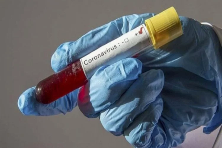 36 laboratuvar daha koronavirüs testi için yetkilendirildi