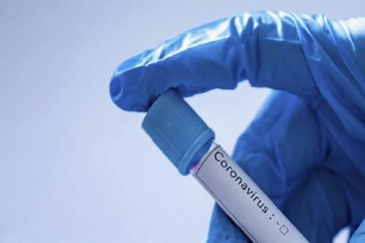 Koronavirüsü kalıcı olarak temizleyen endüstriyel ürün geliştirildi