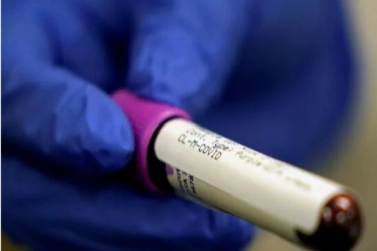 Koronavirüsle mücadele yeni yöntem: Düzenli test