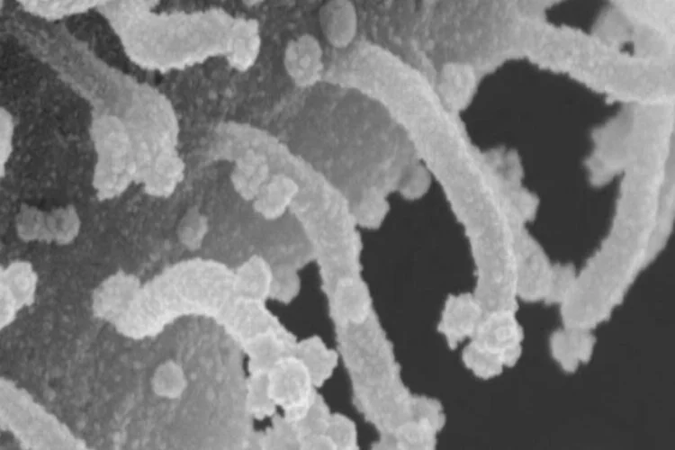 Koronavirüs hücresinin yeni fotoğrafı ortaya çıktı