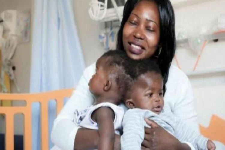 Siyam ikizleri 18 saatlik operasyonla ayrıldı