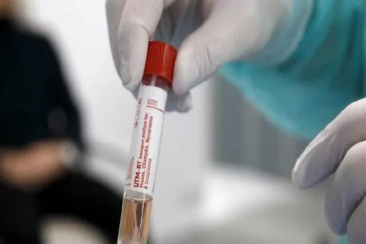 İspanya'da koronavirüs vakalarındaki artış sürüyor