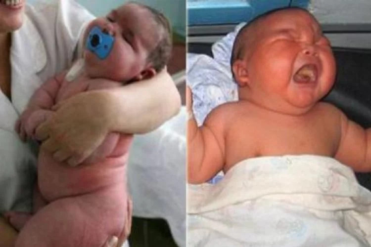 8 Kilo 700 gramlık bebek şaşkınlık yarattı