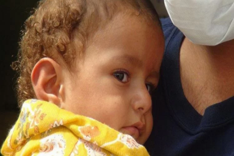 Kolları ve ayakları olmayan Suriyeli bebek, Hatay'a getirildi!