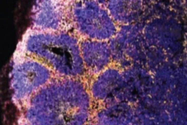 Koronavirüste korkutan keşif: Beyin hücrelerini öldürüyor