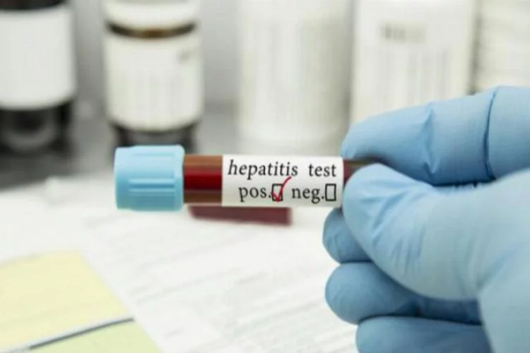 8 adımda hepatitten korunun