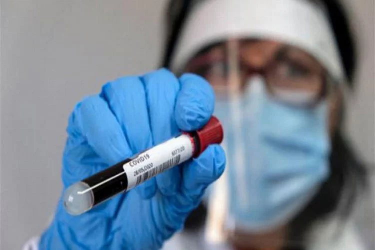 DSÖ Genel Direktörü Ghebreyesus'tan 'koronavirüs testi' açıklaması