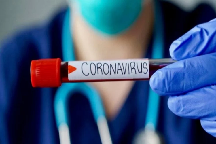 CHP'den koronavirüs raporu
