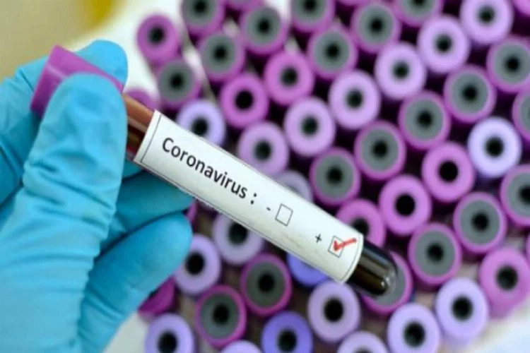 Sağlık Bakanlığı, 80 kelimelik "Koronavirüs Sözlüğü" hazırladı