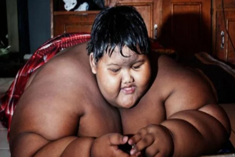 Dünyanın en şişman çocuğu 110 kilo verdi