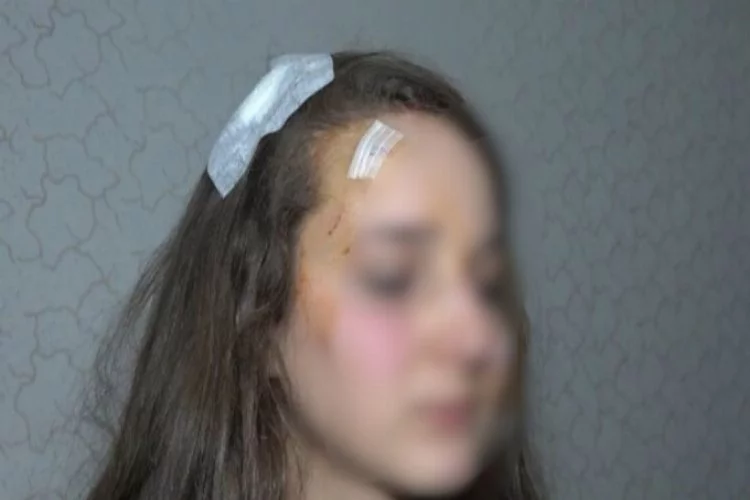 Bursa'da genç kıza sokak ortasında muştalı saldırı!