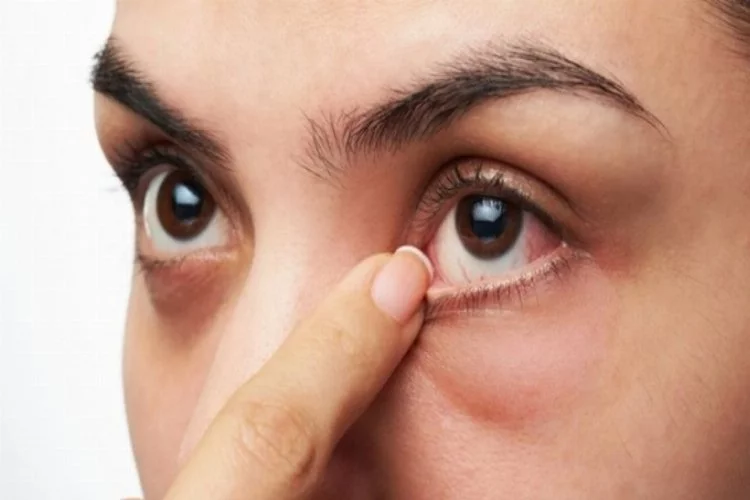 Göz damarlarında meydana gelen tıkanıklık koronavirüs belirtisi mi?