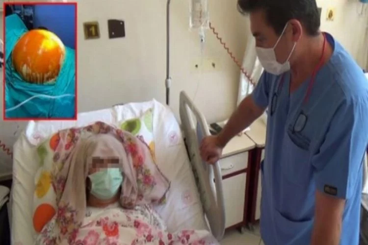 Ameliyat olan kadının karnından 15 kiloluk tümör çıktı!
