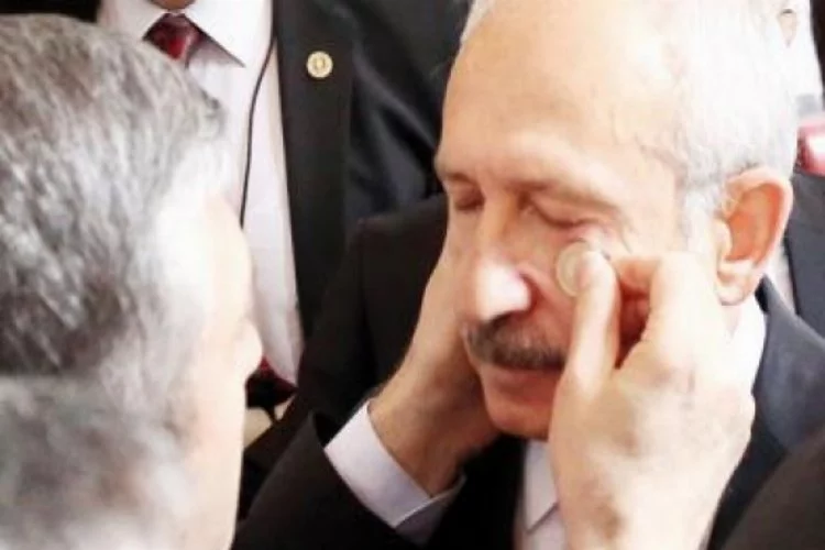 Kemal Kılıçdaroğlu'na skandal tedavi