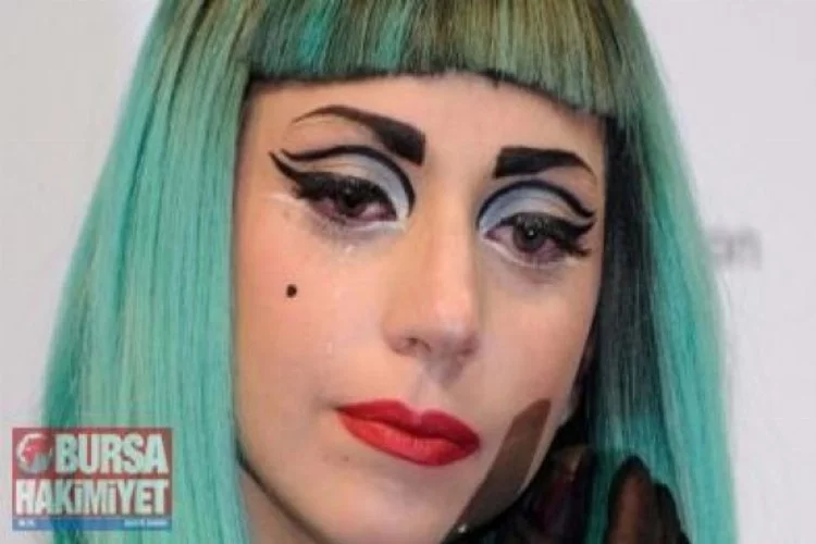  Lady Gaga konserde yaralandı