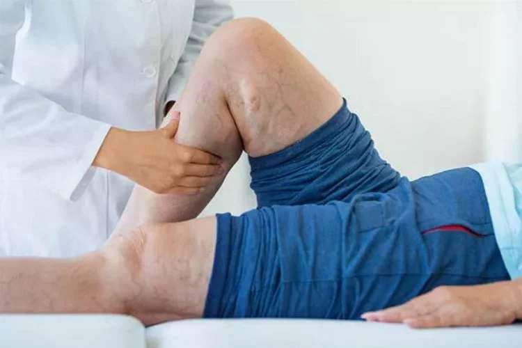 Bacaklarda damar tıkanıklığına neden olan 8 önemli neden