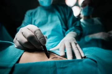 Genital şikayetlerde lazerle tedavi cerrahiye alternatif oluyor