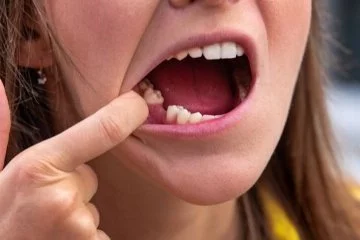 Japonya'da ilaç geliştiriliyor: Dişler yeniden çıkarılabilir